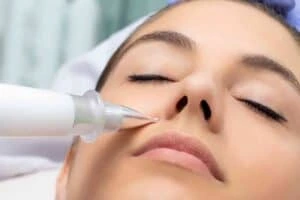 Best Actinic Keratoses Removal 3 Actinic keratoses Small Heath solutions - book in today!